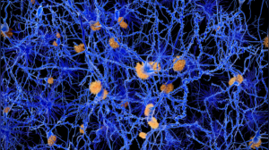 How stress can tighten and disrupt the lymphatic system: 4 key ways