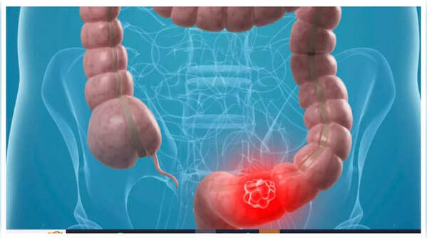 Abdominal pain