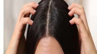 Close-up of hair with dandruff flakes