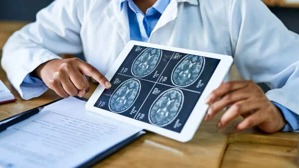 Brain injuries don't always cause violence