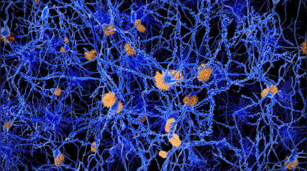 Stress triggers the fight or flight response within our body