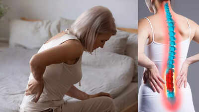 What is osteoporosis: Warning signs, causes, treatment and prevention tips