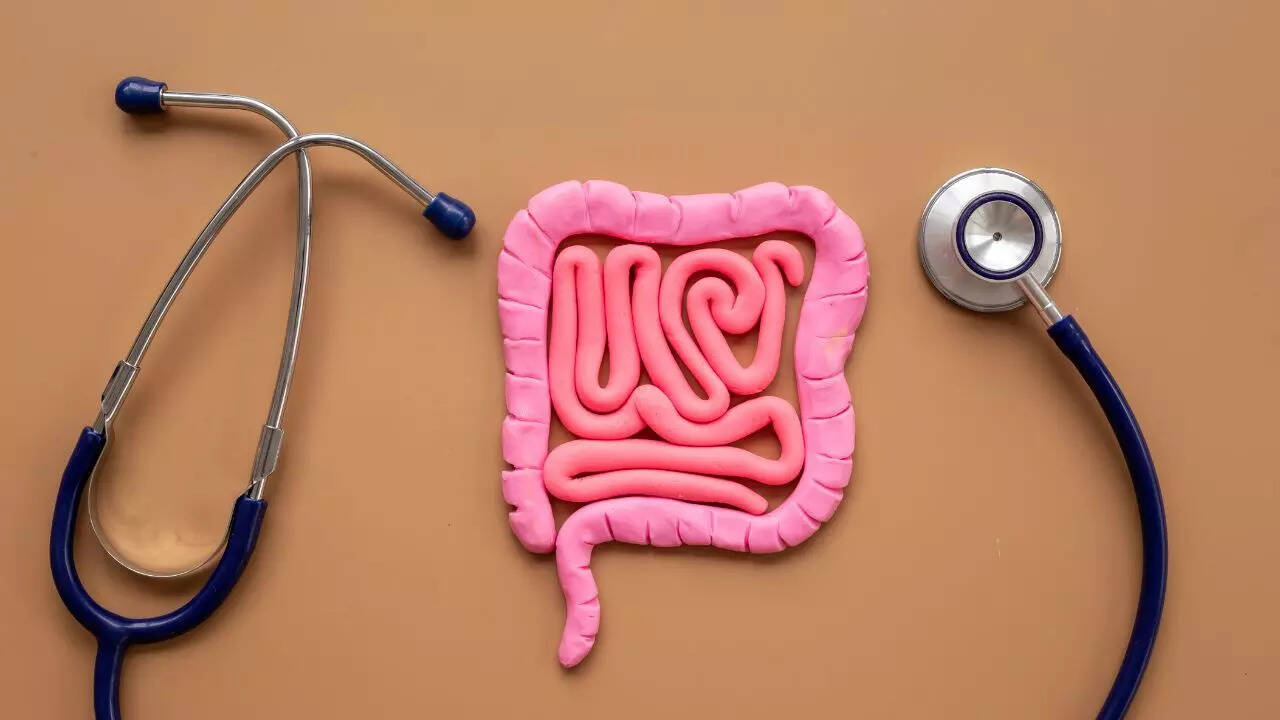 Understanding bowel cancer